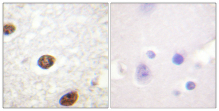 Immunohistochemistry validation of H3F3AH3F3B using Anti-Histone H3