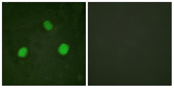 a33954s31 h3f3a primary antibodies if testing 3