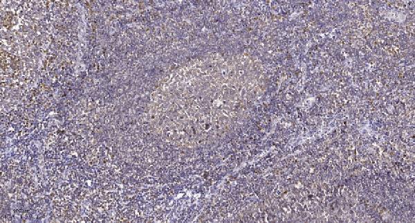 a33954s31 h3f3a primary antibodies ihc testing 2