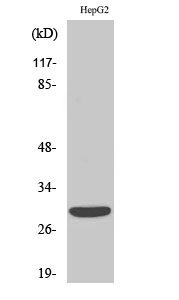 Western blotting validation for Anti-ACBD6 ACBD6LHX4-AS1 Antibody A33955
Western Blot (WB) analysis of specific cells using ACBD6 polyclonal antibody