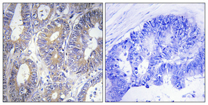 a33957 bcl2l2 primary antibodies ihc testing 4