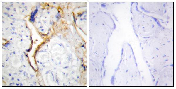 Immunohistochemistry analysis of paraffin-embedded human placenta tissue, using CKI-epsilon Antibody