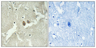 Immunohistochemistry validation of HMP19 using Anti-HMP19 Antibody (A33961)