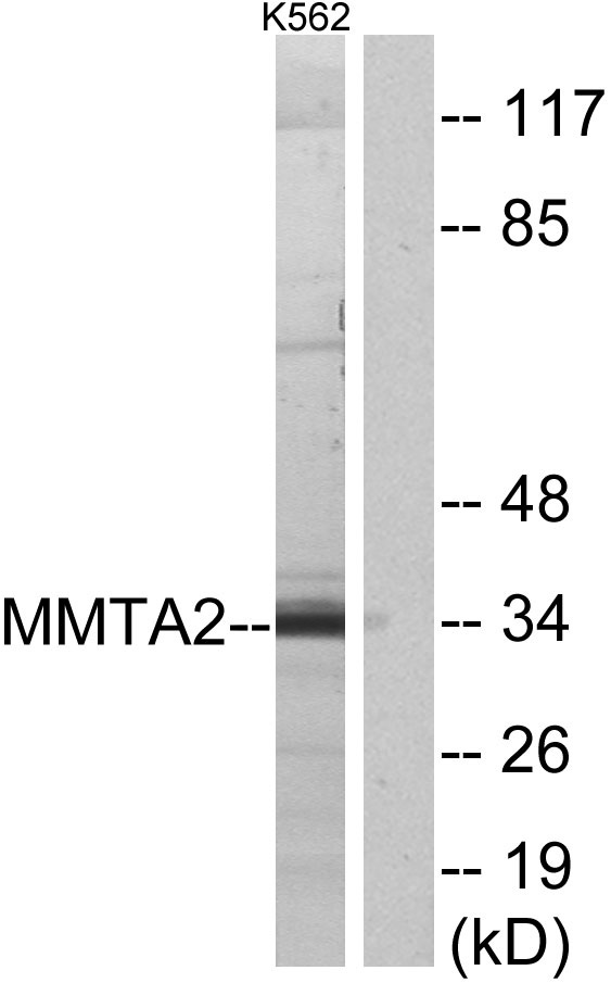 Western blot analysis of lysates from K562 cells, using MMTAG2 Antibody