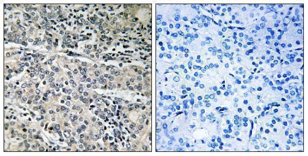 a33965 c14orf2 primary antibodies ihc testing 1