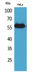 a33968 amylase primary antibodyes wb testing 1