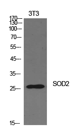Western blotting validation for Anti-SOD-2 SOD2SOD2-OT1 Antibody A33970
Western Blot (WB) analysis of NIH-3T3 cells using SOD-2 polyclonal antibody
