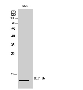 Western Blot analysis of K562 cells using MIP-1b Polyclonal Antibody diluted at 1:500