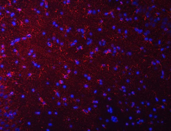a34007 septin2 primary antibodies if testing 11