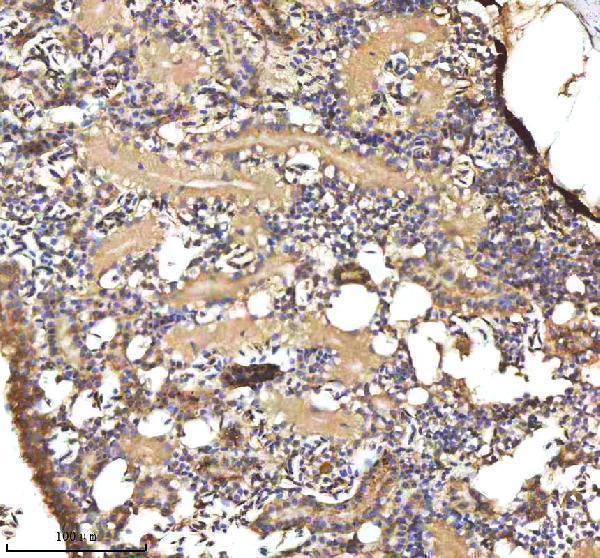 aza0a0g2kyh9 cxcl8a primary antibodies ihc testing 2
