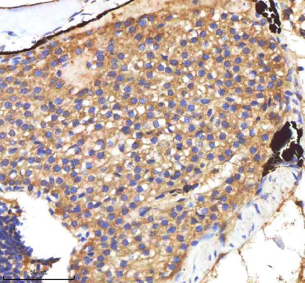 aza0a0g2kyh9 cxcl8a primary antibodies ihc testing 3