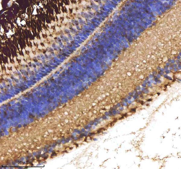 aza0a0g2kyh9 cxcl8a primary antibodies ihc testing 4