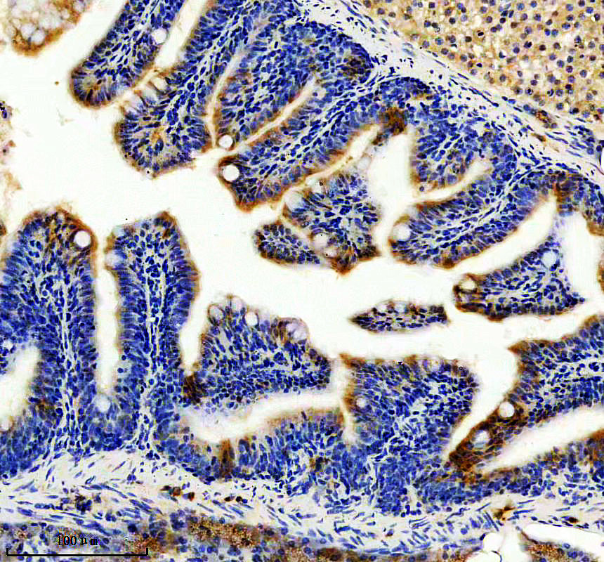 aza0a0r4iew8 elavl4 primary antibodies ihc testing 1