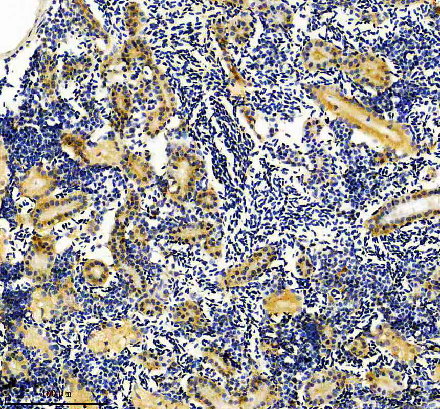 aza0a0r4iew8 elavl4 primary antibodies ihc testing 2