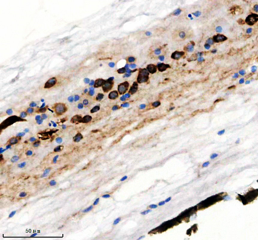 aza0a0r4iew8 elavl4 primary antibodies ihc testing 3