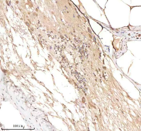 IHC analysis of PSMC3 using anti-PSMC3 antibody (AZA0A0R4ILA8)