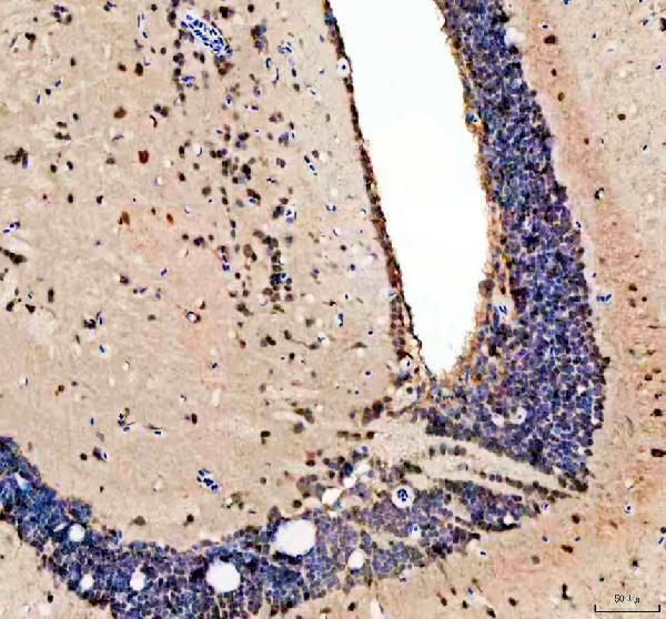 IHC analysis of PSMC3 using anti-PSMC3 antibody (AZA0A0R4ILA8)