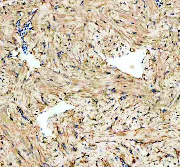 aza0a0r4ila8 psmc3 primary antibodies ihc testing 3