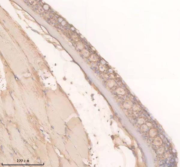 aza0a0r4imy7 trpm2 primary antibodies ihc testing 1