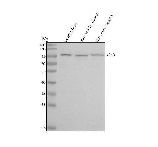  Western blot analysis of Importin Beta/KPNB1 using anti-Importin Beta/KPNB1 antibody (AZA0A0R4IMZ8)