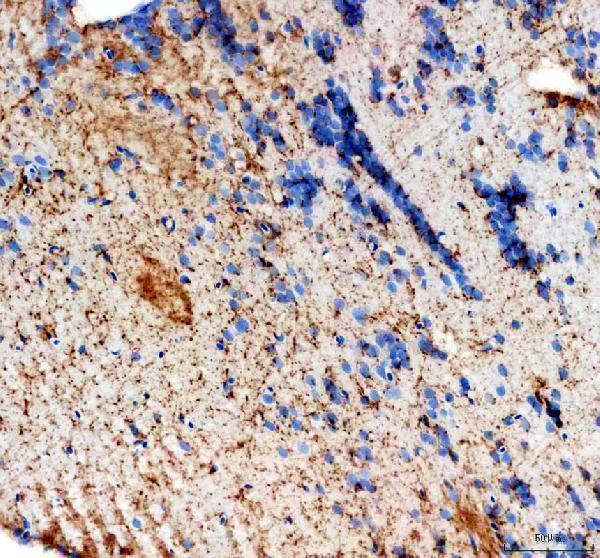 aza0a0r4iqg1 hmgcs1 primary antibodies ihc testing 1