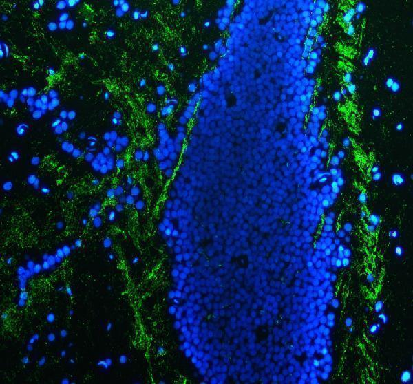aza0a0r4is04 mpz primary antibodies if testing 1