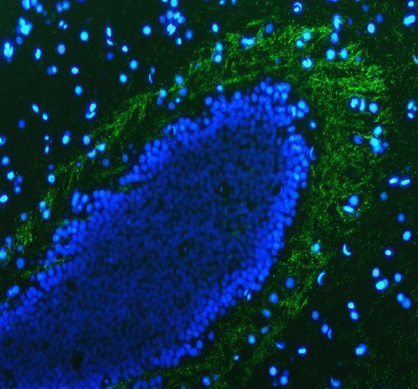 aza0a0r4is04 mpz primary antibodies if testing 2