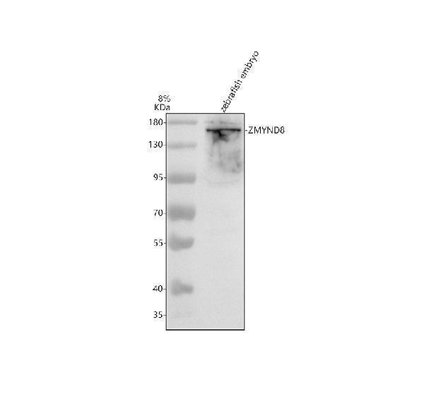 Western blot analysis of ZMYND8 using anti-ZMYND8 antibody (AZA0A0R4ISB9)