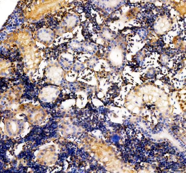IHC analysis of Vitamin D binding protein/GC using anti-Vitamin D binding protein/GC antibody (AZA0A0R4ITN2)