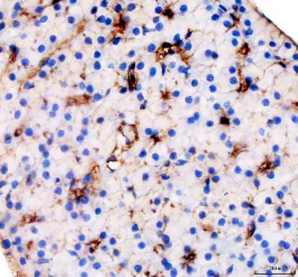 IHC analysis of Vitamin D binding protein/GC using anti-Vitamin D binding protein/GC antibody (AZA0A0R4ITN2)