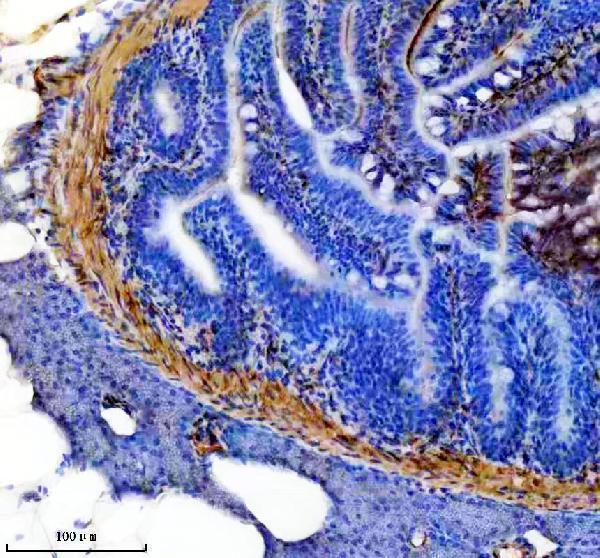 IHC analysis of TPM1 using anti-TPM1 antibody (AZA0A1L6UW63)