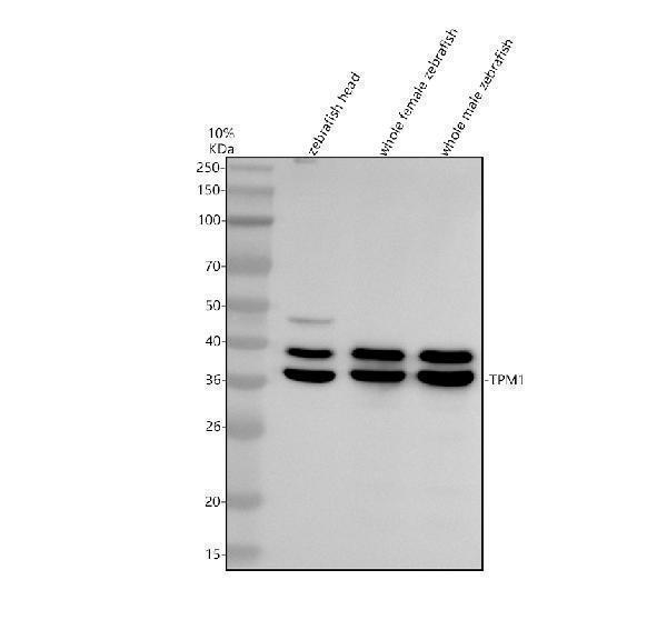 Western blot analysis of TPM1 using anti-TPM1 antibody (AZA0A1L6UW63)