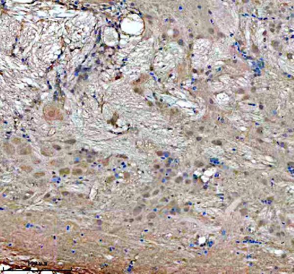  IHC analysis of GBF1 using anti-GBF1 antibody (AZA0A286Y9X1)