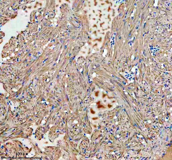  IHC analysis of GBF1 using anti-GBF1 antibody (AZA0A286Y9X1)