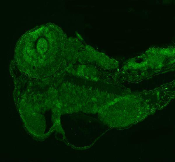IF analysis of PRPF6 using anti-PRPF6 antibody (AZA0A2R8PWG5)