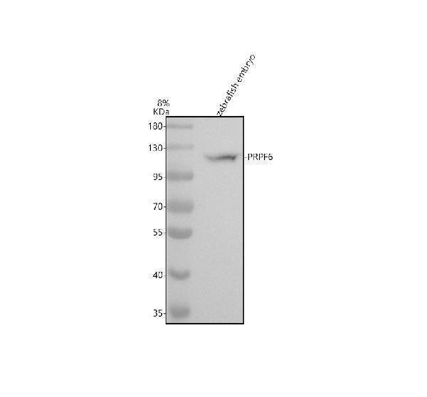 Western blot analysis of PRPF6 using anti-PRPF6 antibody (AZA0A2R8PWG5)