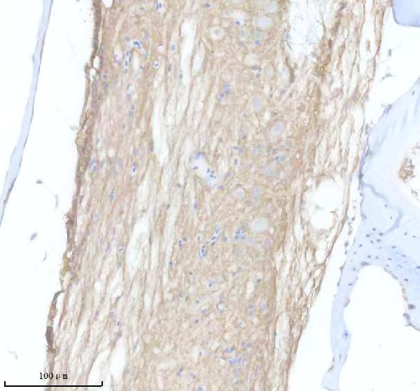 aza0a2r8pyr8 ackr3a primary antibodies ihc testing 1