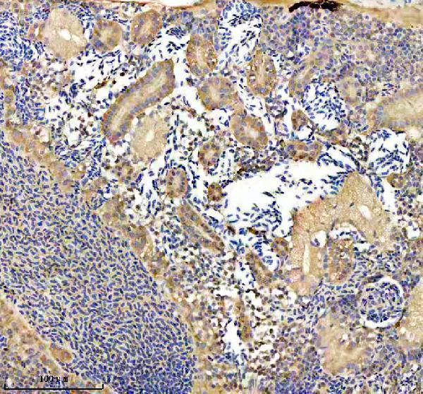 aza0a2r8q1x2 eno1a primary antibodies ihc testing 2