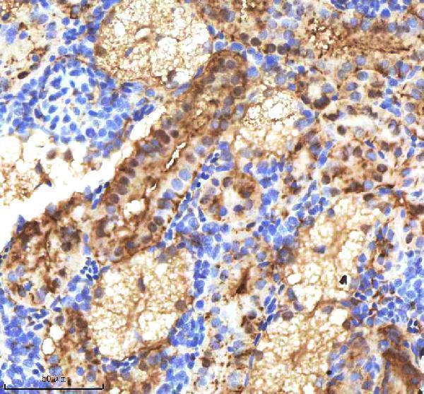 aza0a2r8q5a3 etsrp primary antibodies ihc testing 2