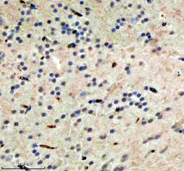  IHC analysis of HDAC1 using anti-HDAC1 antibody (AZA0A2R8QIW0)