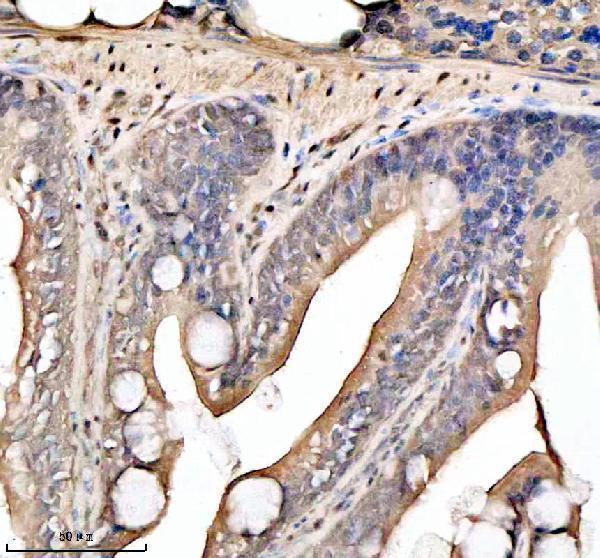  IHC analysis of HDAC1 using anti-HDAC1 antibody (AZA0A2R8QIW0)