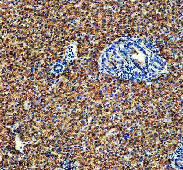  IHC analysis of IDH3B using anti-IDH3B antibody (AZA0A2R8QPC9)