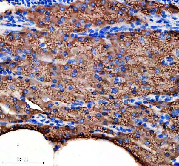  IHC analysis of IDH3B using anti-IDH3B antibody (AZA0A2R8QPC9)