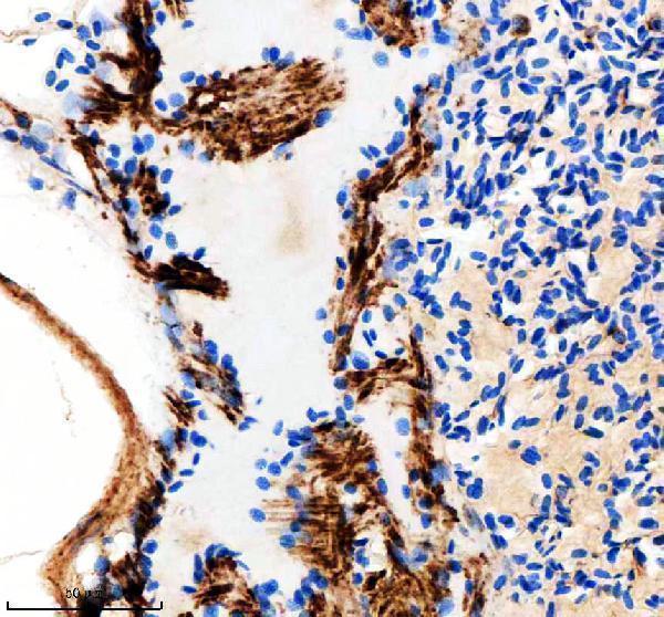  IHC analysis of IDH3B using anti-IDH3B antibody (AZA0A2R8QPC9)
