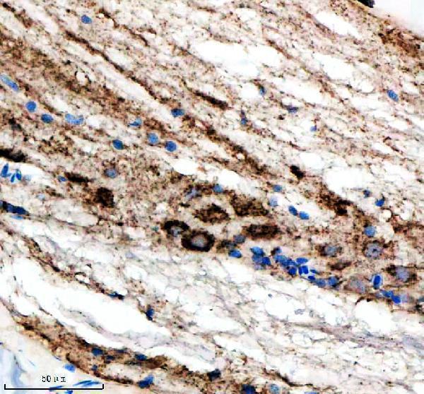aza0a2r8qpc9 idh3b primary antibodies ihc testing 5