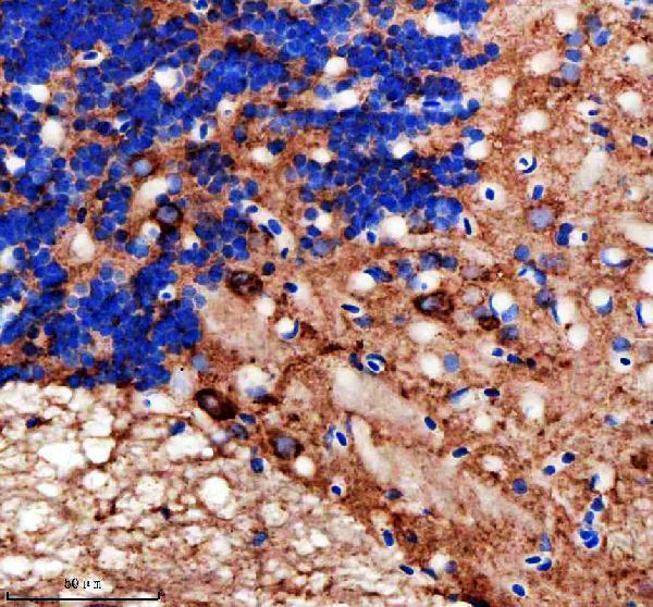 aza0a2r8qpc9 idh3b primary antibodies ihc testing 6