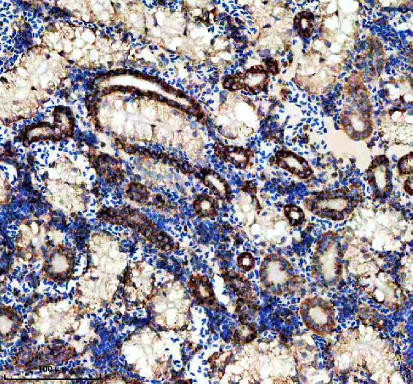 aza0a2r8qpc9 idh3b primary antibodies ihc testing 7