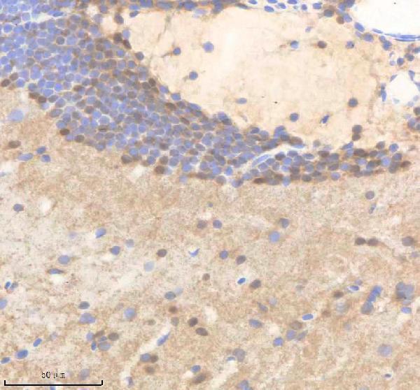 aza0a8m1n062 polr2d primary antibodies ihc testing 1