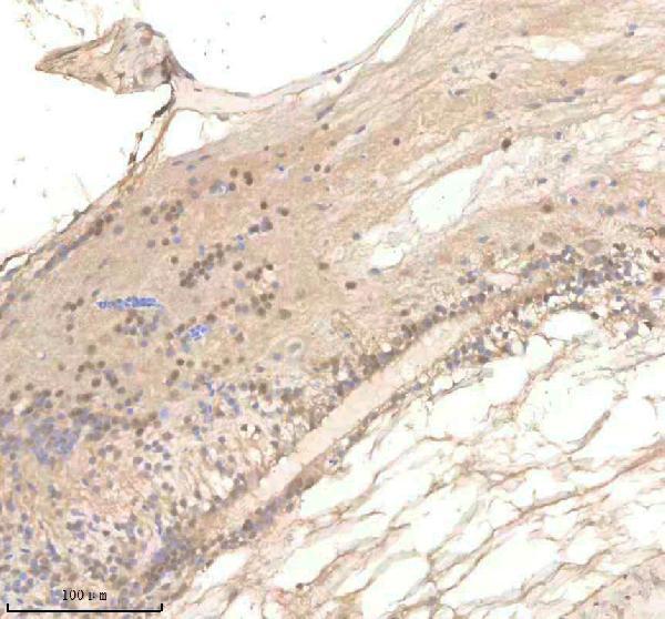 aza0a8m1n062 polr2d primary antibodies ihc testing 2