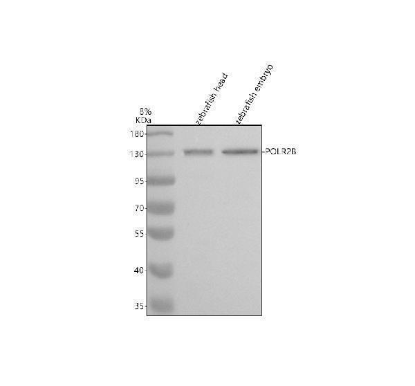 Western blot analysis of POLR2B using anti-POLR2B antibody (AZA0A8M1N6S0)